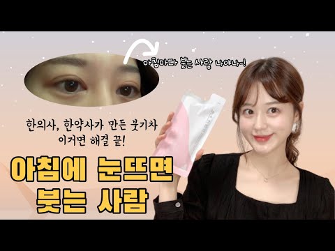 붓기차추천 | 한의사,한약사분들이 만든 한방차 | 호랑이건강원 린미인차 솔직리뷰 ❤️