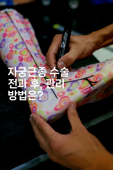 자궁근종 수술 전과 후, 관리 방법은?